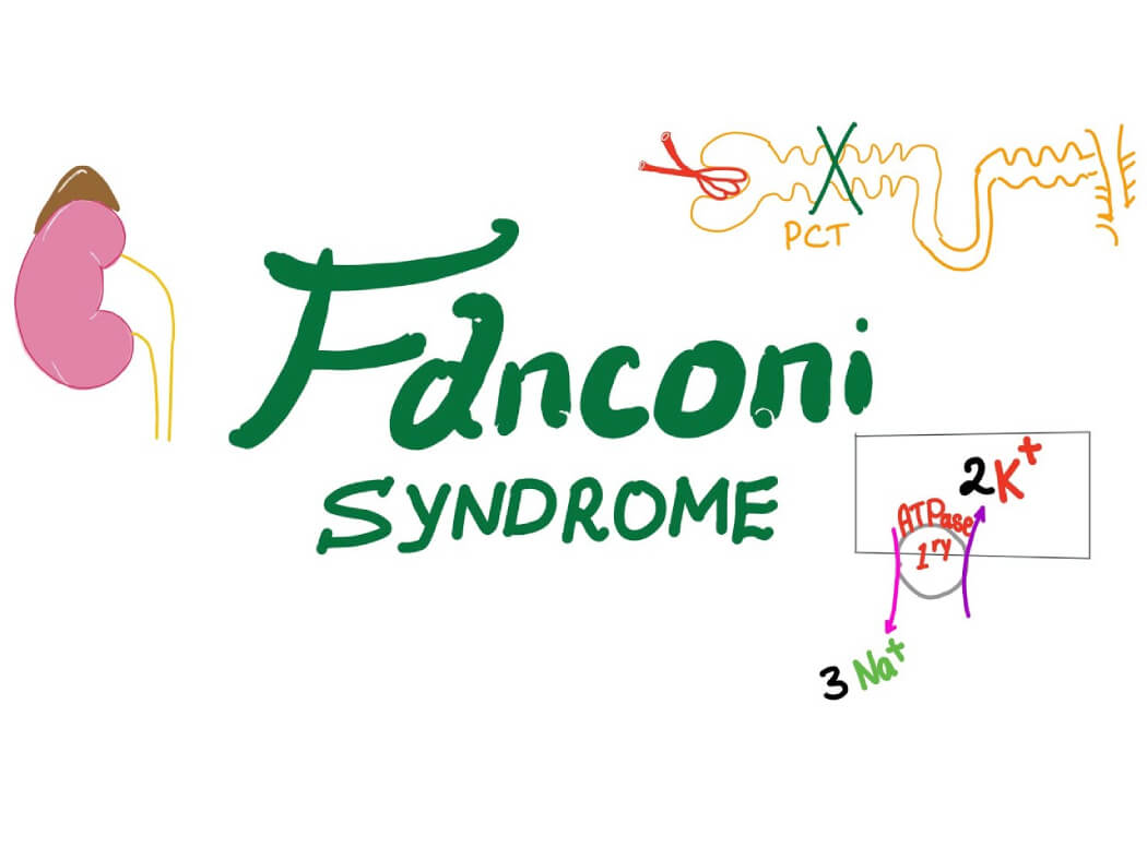Hội chứng Fanconi