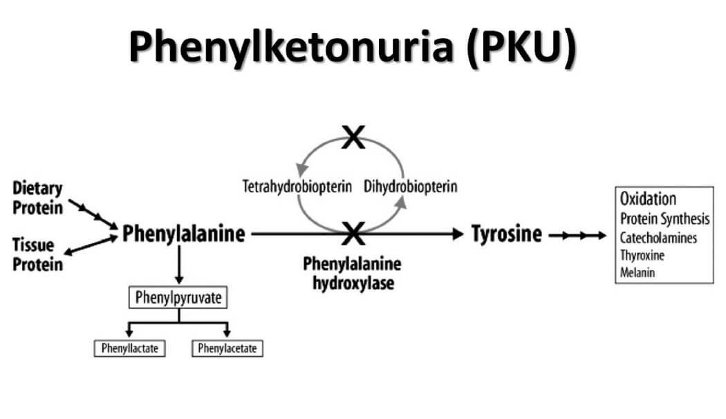 cơ chế gây bệnh phenylketo niệu ở người