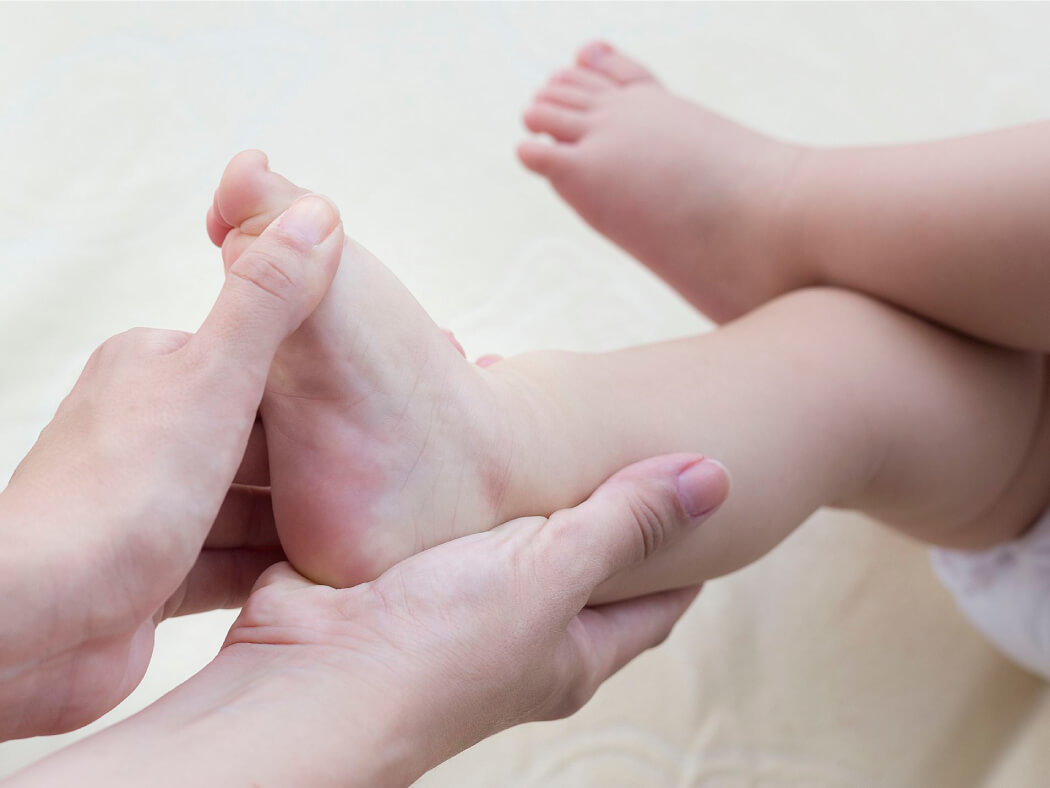 dị tật bàn chân ở trẻ