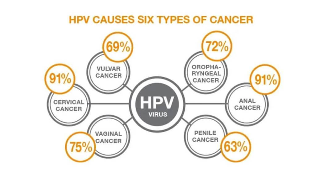 HPV và 6 loại ung thư