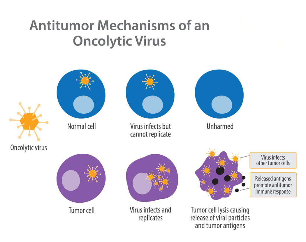 Liệu pháp Oncolytic virus