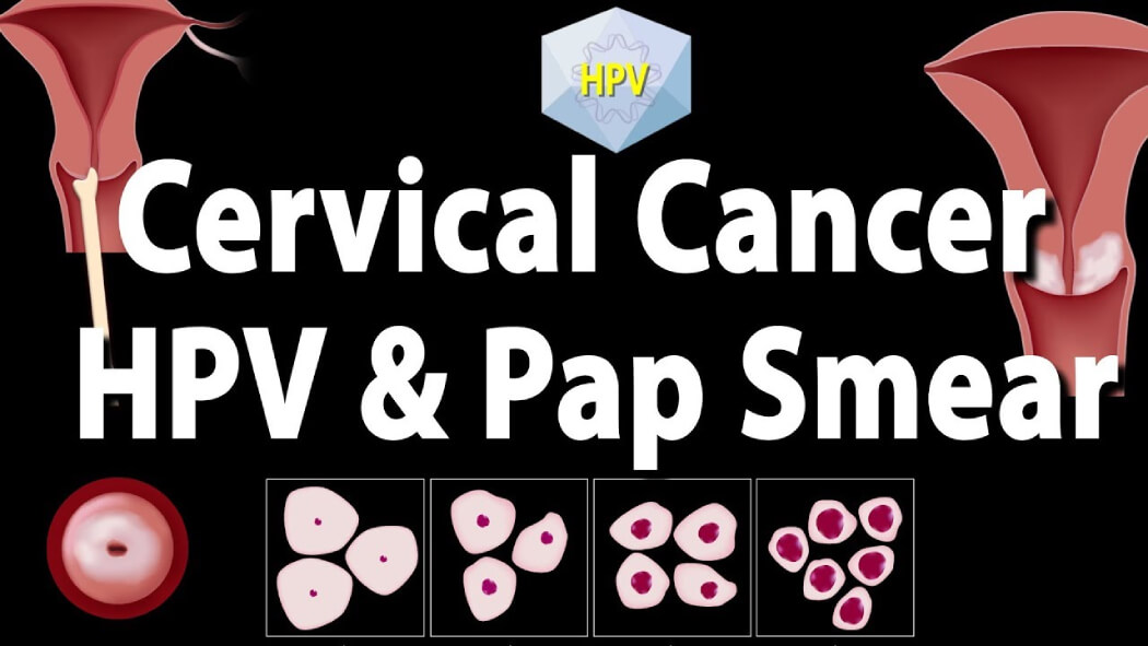 HPV test và Pap Smear