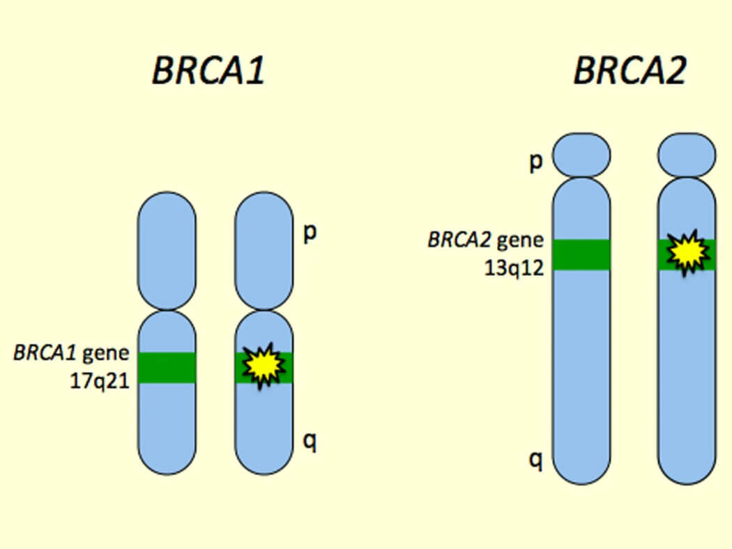 gen Brca1 và Brca2