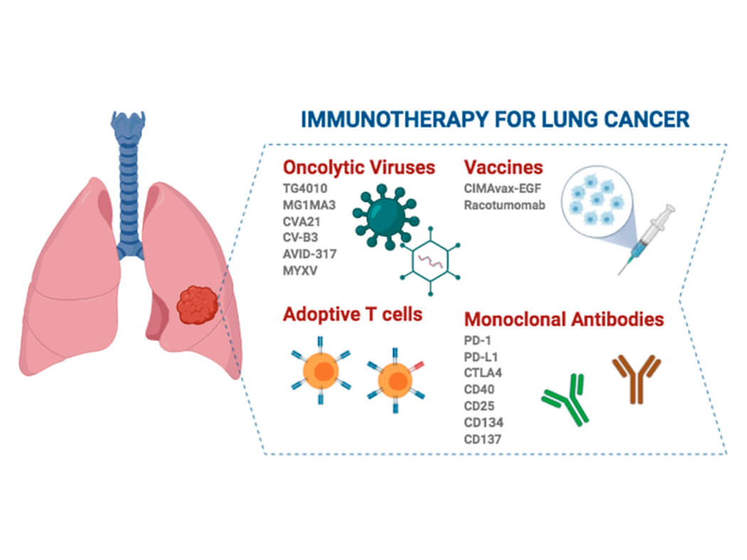 Liệu pháp miễn dịch trong điều trị ung thư phổi