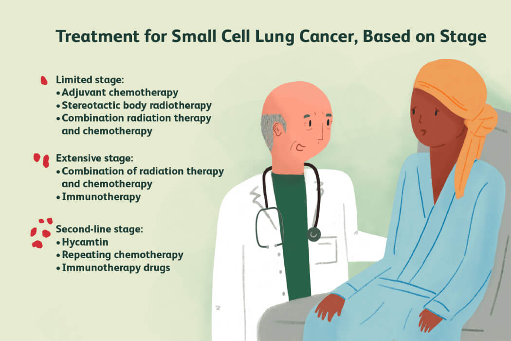 điều trị ung thư phổi tế bào nhỏ