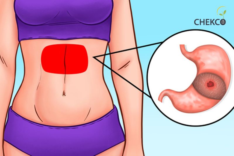 Cách phát hiện ung thư dạ dày giai đoạn đầu