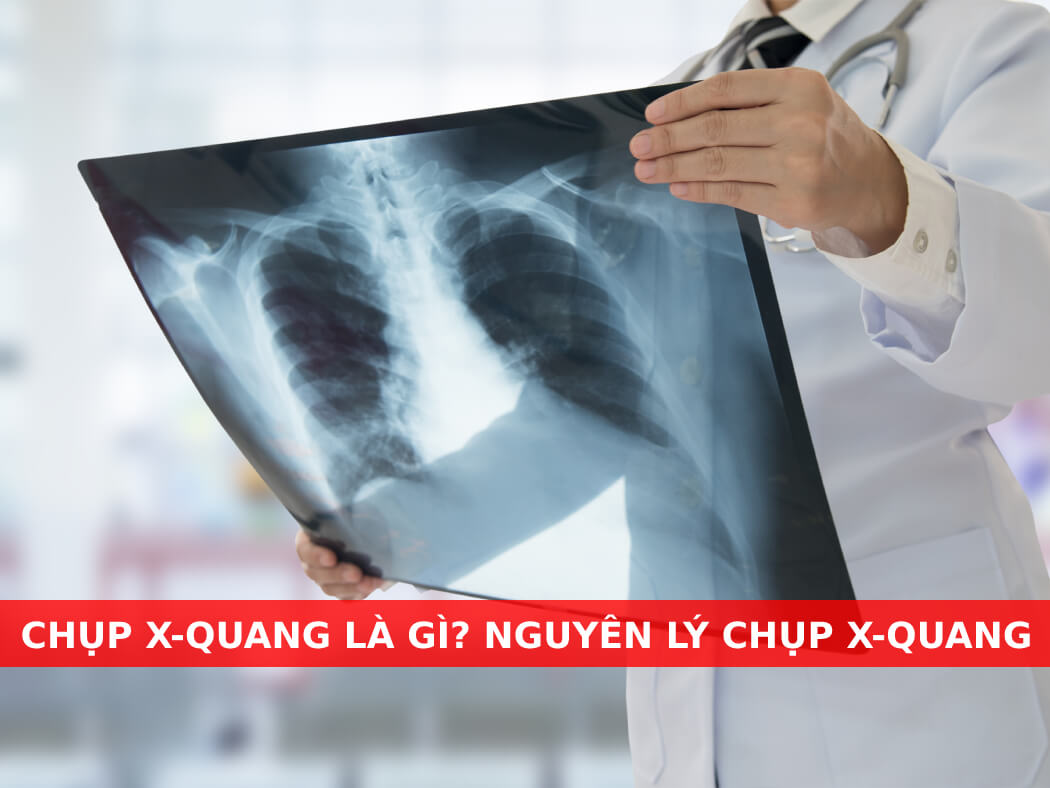 chụp x-quang là gì