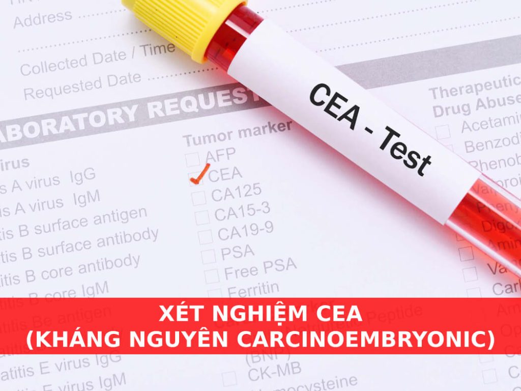 xét nghiệm CEA (kháng nguyên carcinoembryonic)