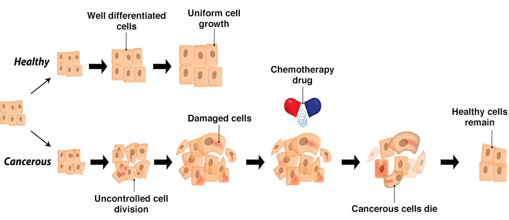 chemotherapy and cancer illustration 10a08b