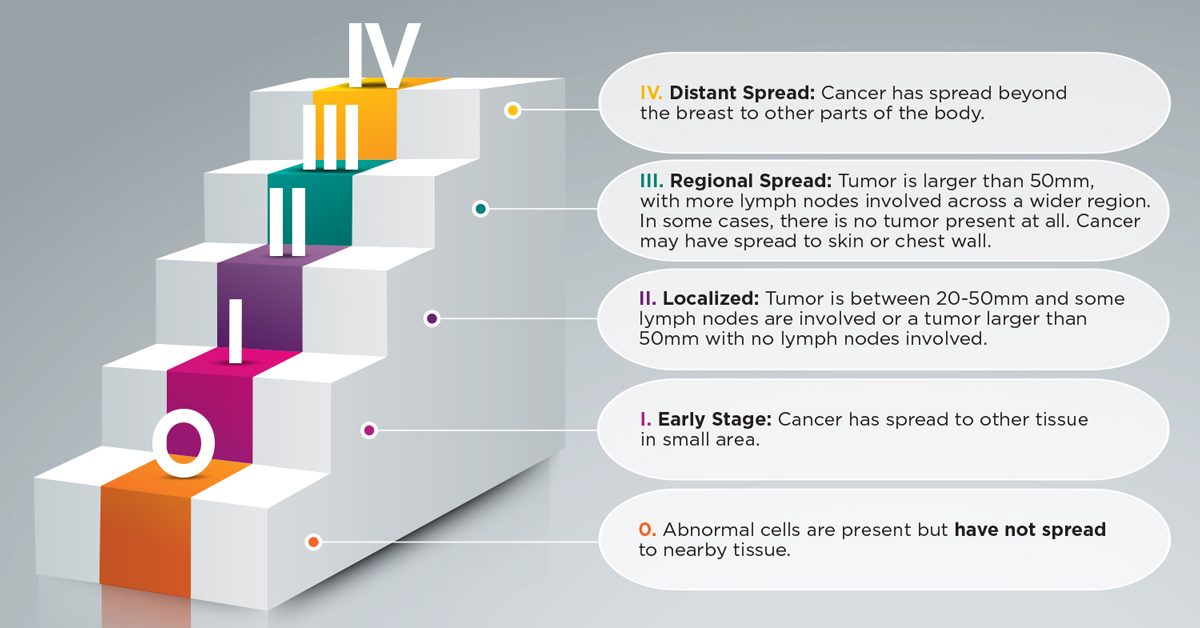 breast infographic5 v2 3x2 e1712203838679